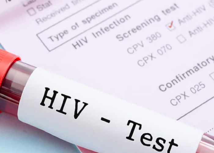 Jangan Takut Tes HIV! Kemenkes Perluas Akses Deteksi Dini Demi Tekan Penularan