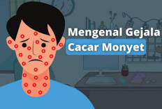 Waspada Cacar Monyet: Kenali Gejala untuk Deteksi dan Penanganan Dini