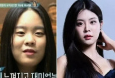 Putri 'Miss Korea Jin' Woo Ji-won, Woo Seo-yoon, Hadapi Kontroversi Operasi Plastik